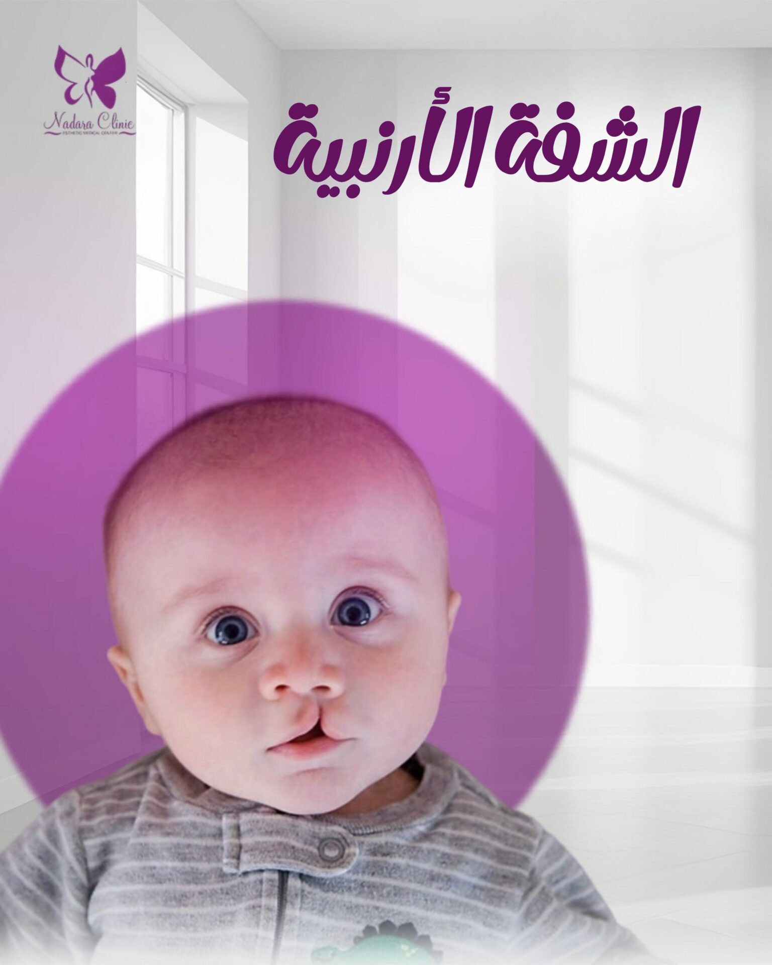 الشفة الأرنبية